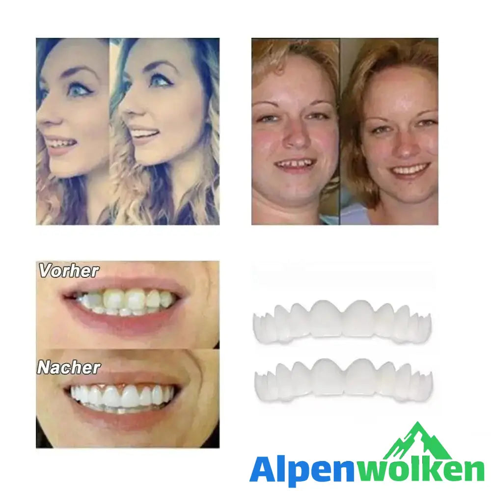 Alpenwolken - 1 SET DIAMOND SMILE VENEERS (OBEN & UNTEN ZÄHNE)