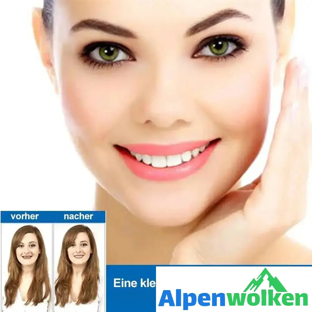 Alpenwolken - 1 SET DIAMOND SMILE VENEERS (OBEN & UNTEN ZÄHNE)