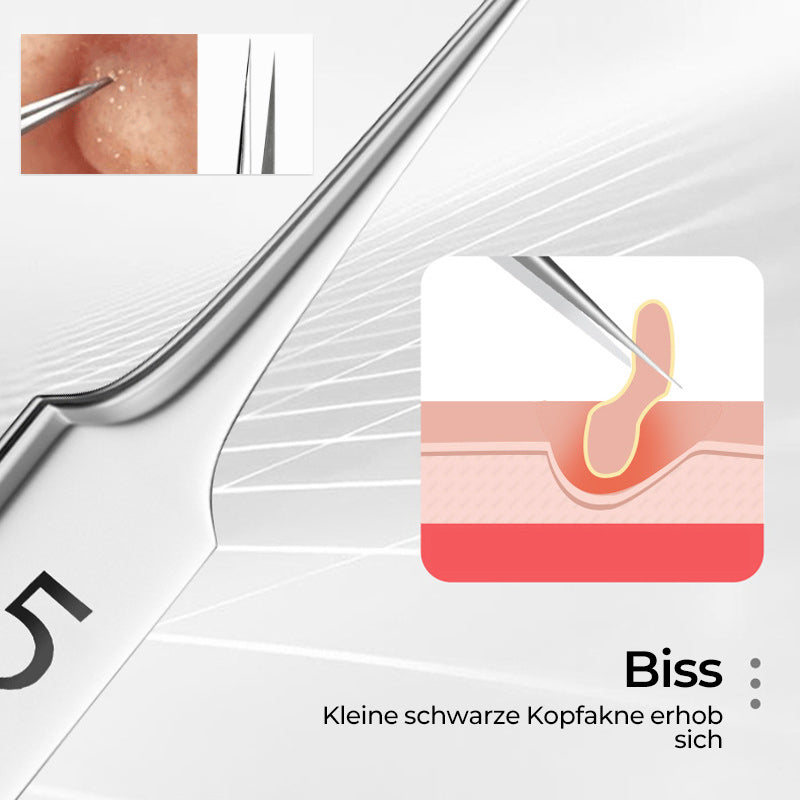 Alpenwolken - Professionelle Pinzette zum Entfernen von Mitessern im Gesicht
