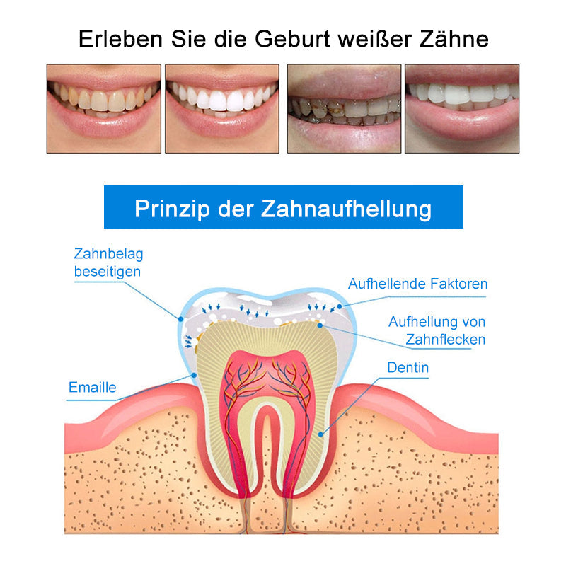 Alpenwolken - 🥰Zahnreinigungs- und Aufhellungsstift✨