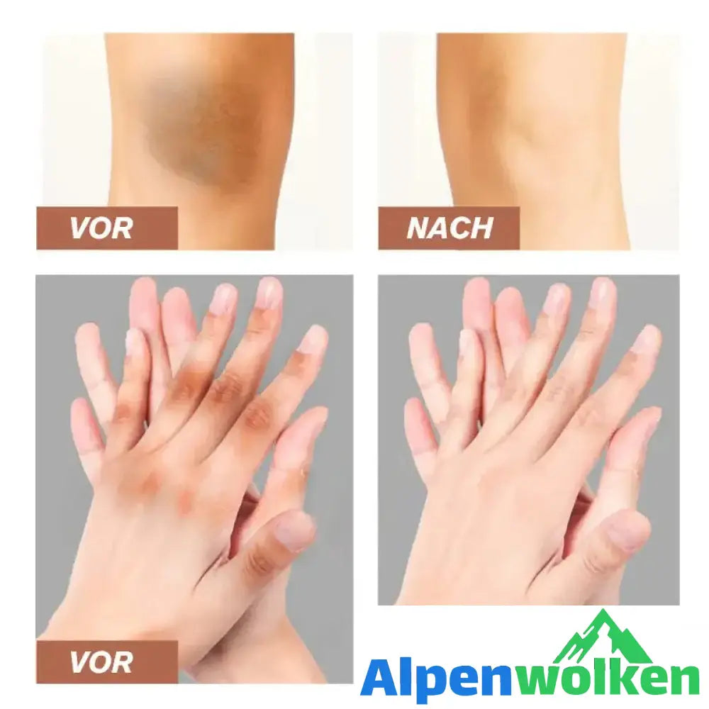 Alpenwolken - Melanin-Entfernung Aufhellende Creme